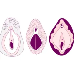 Fem olika vulvor, vissa med hår på snippan, visar variationen i anatomin.