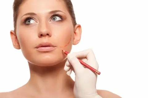 En hand i handske markerar ansiktet med en röd penna, förberedelse för buccal fat removal.