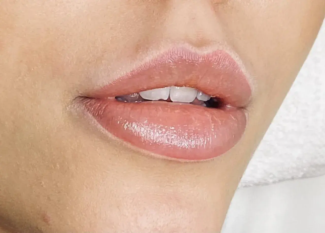 Fylliga läppar med en naturlig rosa ton efter lip blush-behandling. Vackert och fräscht resultat.