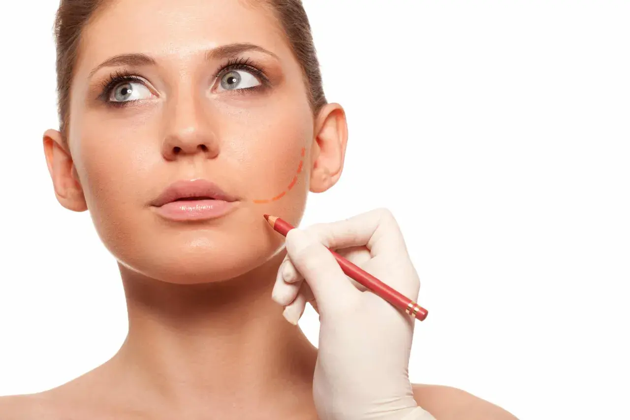 En hand i handske markerar ansiktet med en röd penna, förberedelse för buccal fat removal.