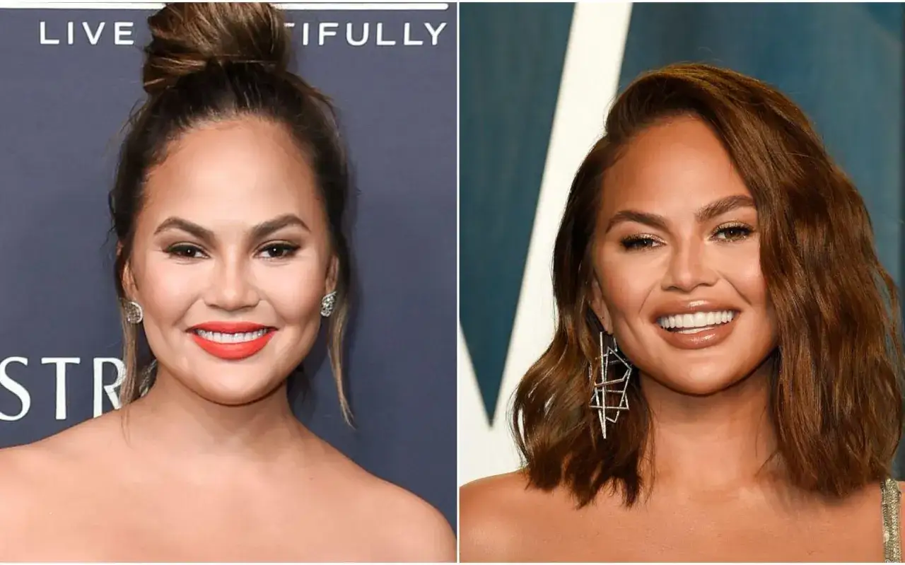 Chrissy Teigen före och efter buccal fat removal. Bilden visar en jämförelse av hennes ansiktsform.