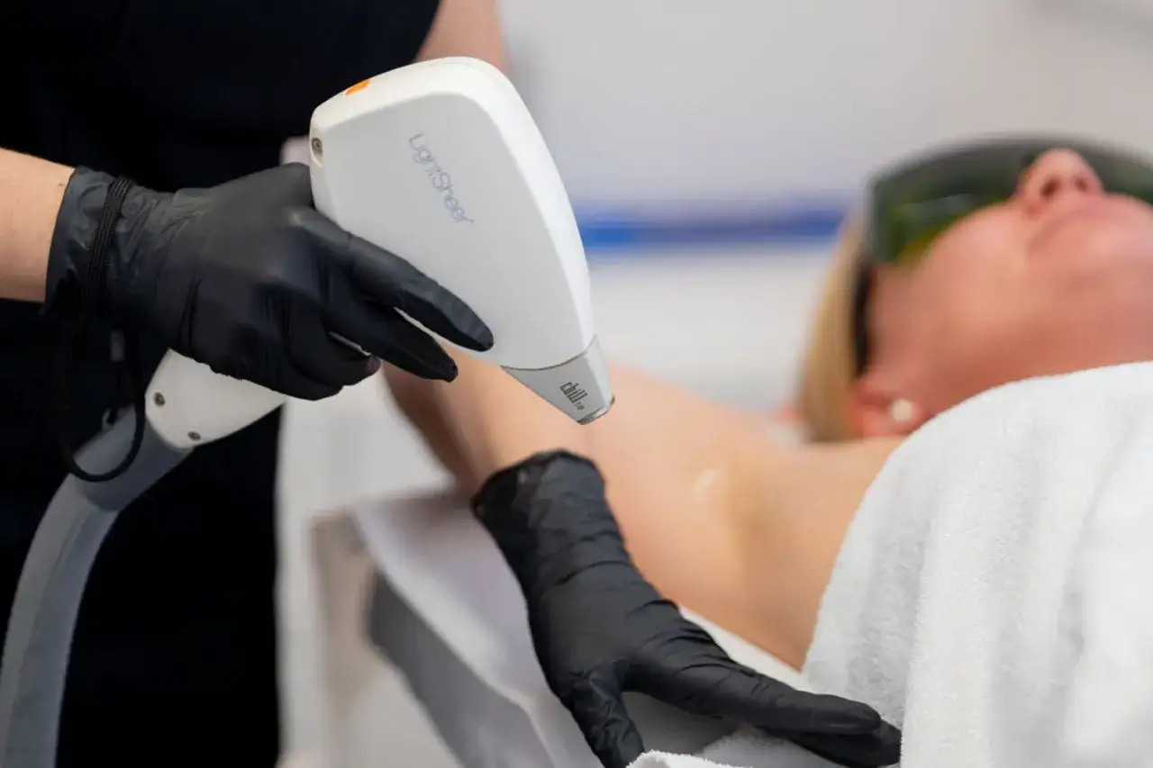 En person med svarta handskar utför laserhårborttagning på en armhåla för att ta bort hår under armarna.